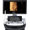 WS80A - Samsung WS80A - Refurbished Ultrasound Samsung DiagnosisCo Samsung WS80A